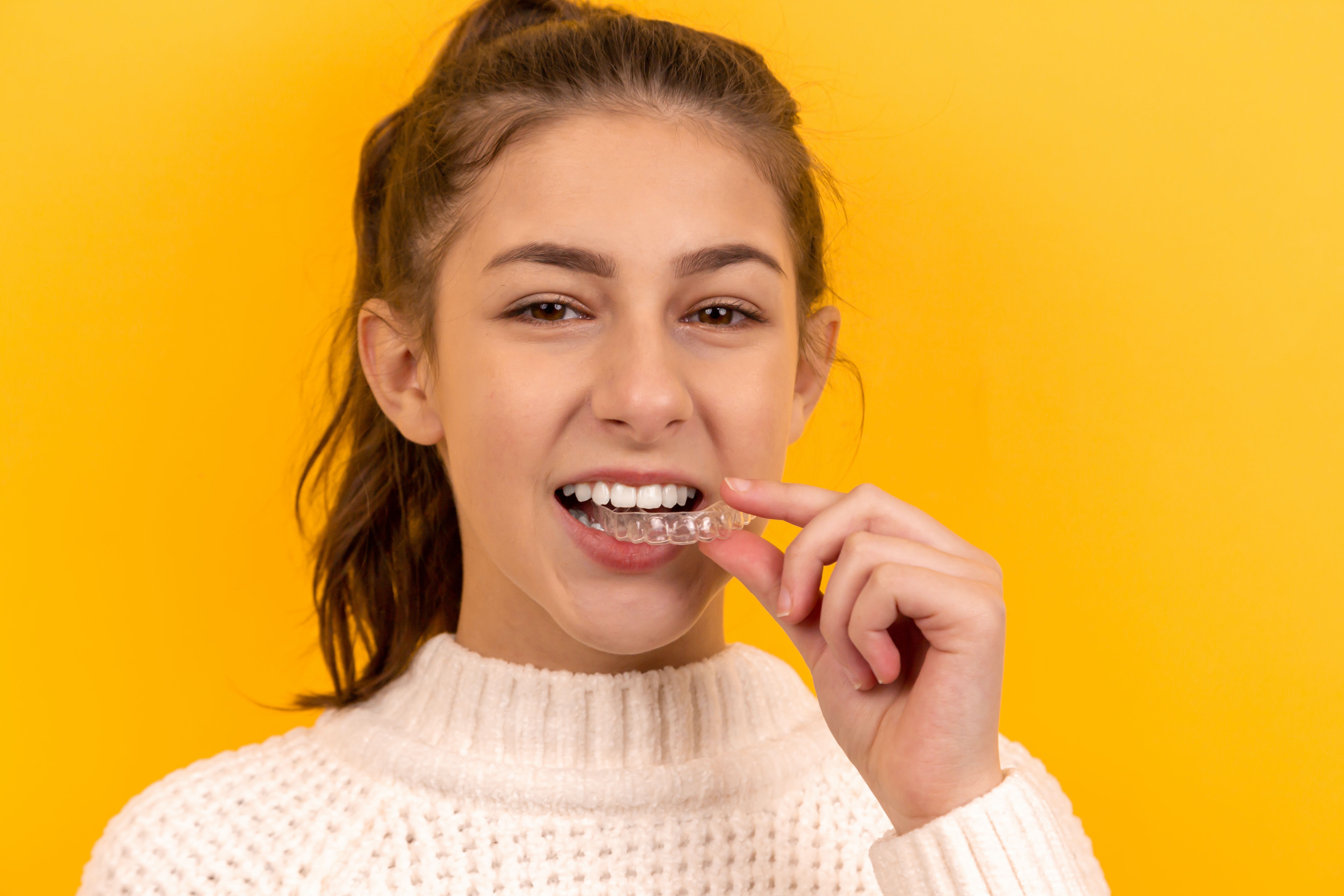Maintaining straight teeth following Orthodontics – Retainers.